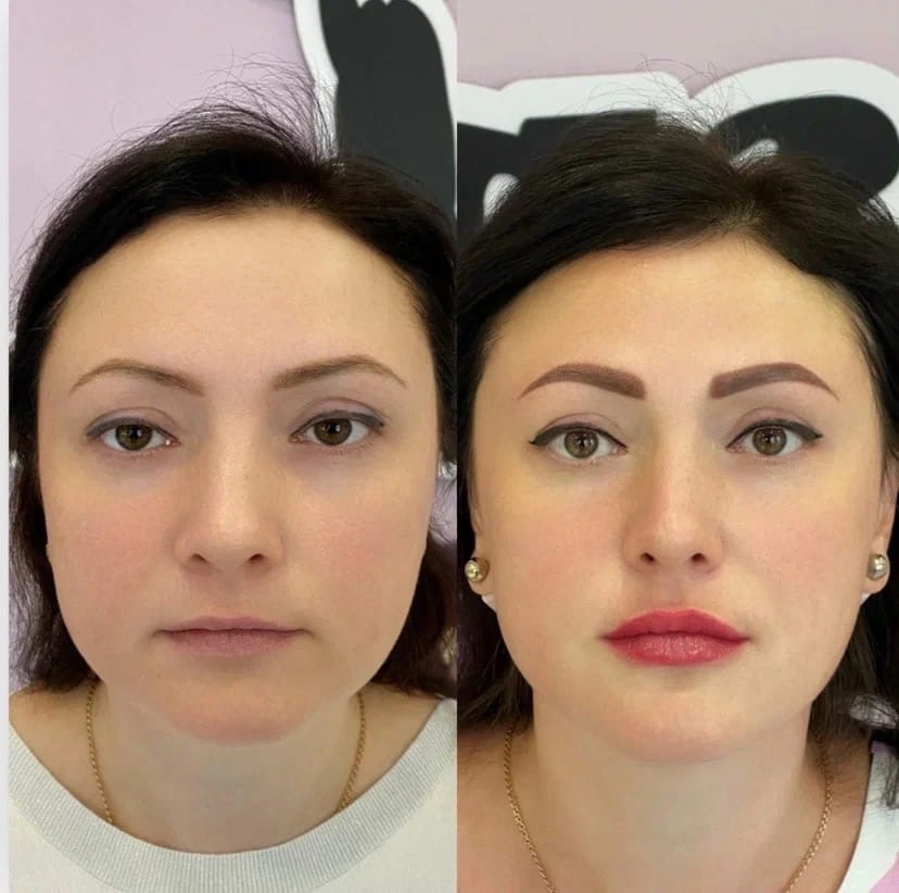 5 самых популярных причин, по которым делают ПМ бровей: